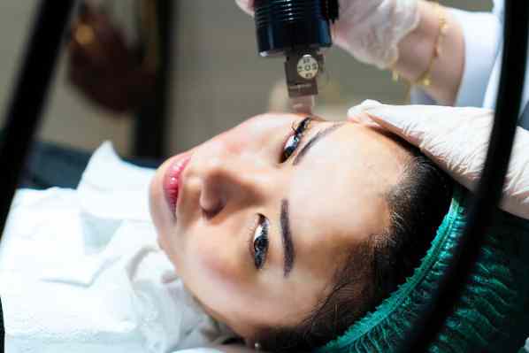 میکرونیدلینگ برای درمان لکه های پوستی
