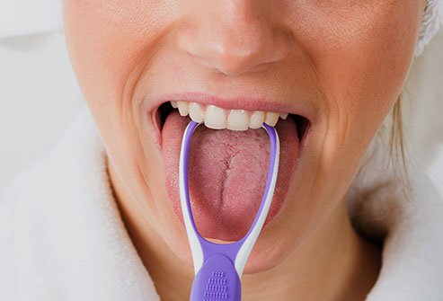 باکتری های روی زبان شما اغلب باعث بوی بد دهان می شوند.