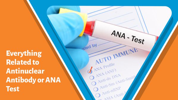 آزمایشANA