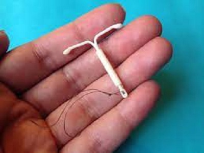 استفاده از IUD برای پیشگیری از بارداری